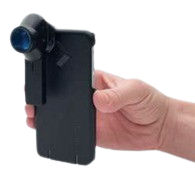 Telemedicine Dermoscope